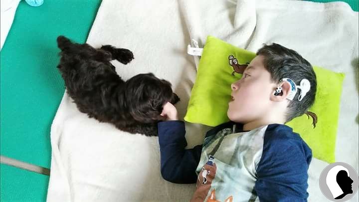 CI Kopf 2018 männlich Kind